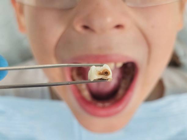 Best Emergency Gum Treatment in Franklin, MI